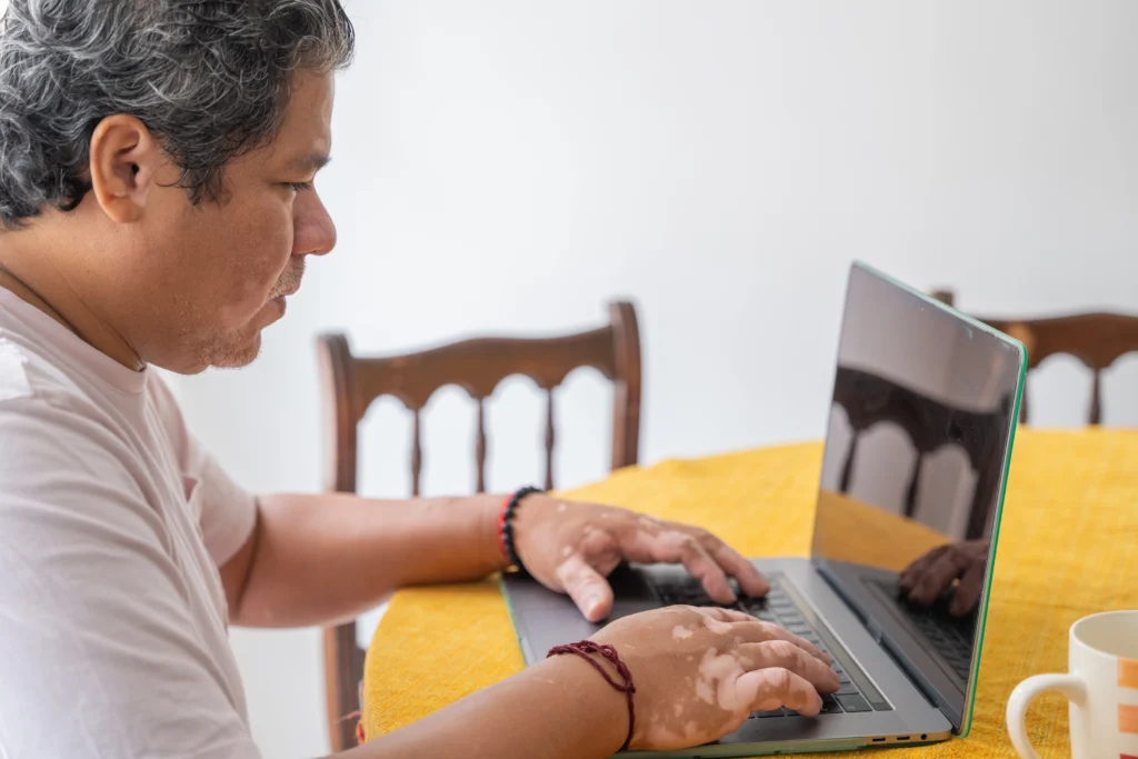 Permanent resident checking green card renewal status online after filing Form I-90 and receiving USCIS receipt notice